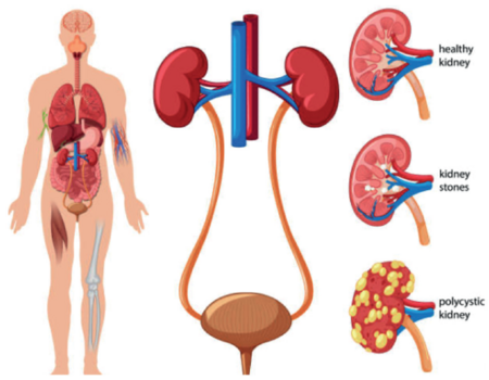 Crew Health Advice: Kidneys